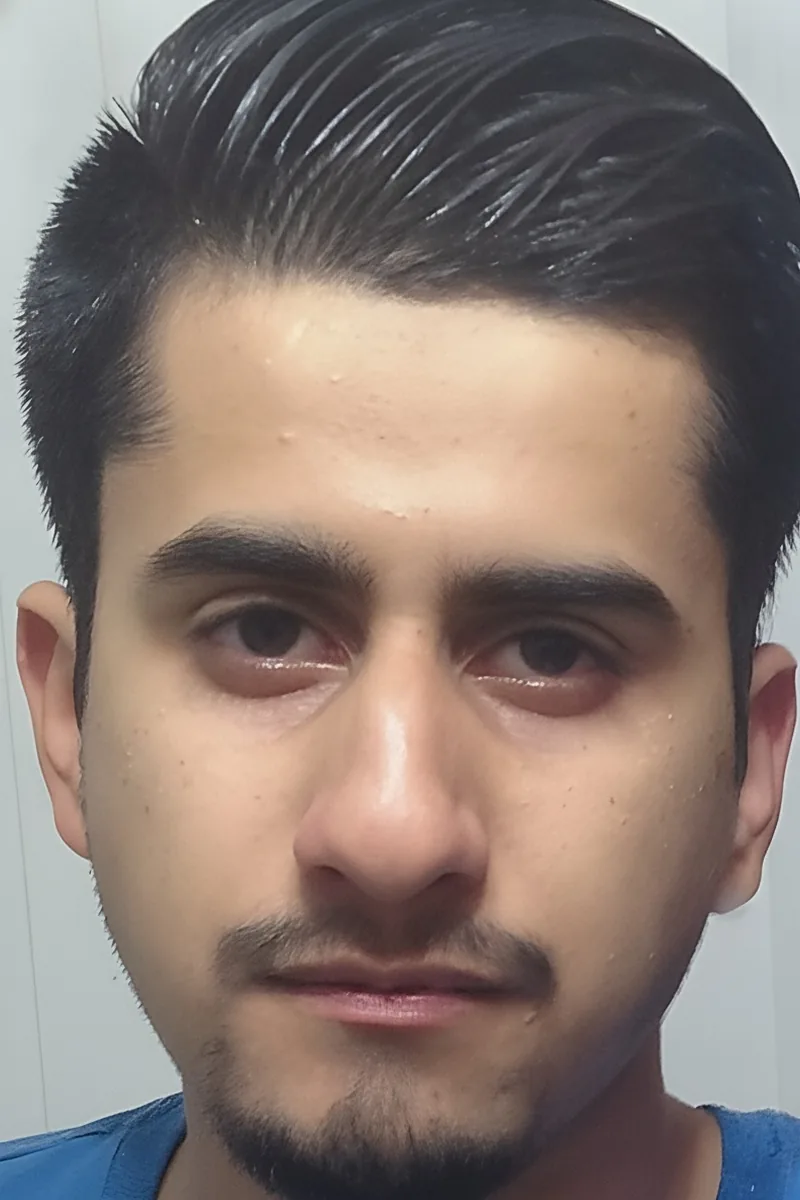 Bilal