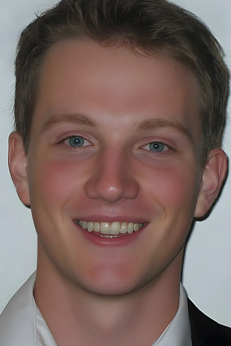 James